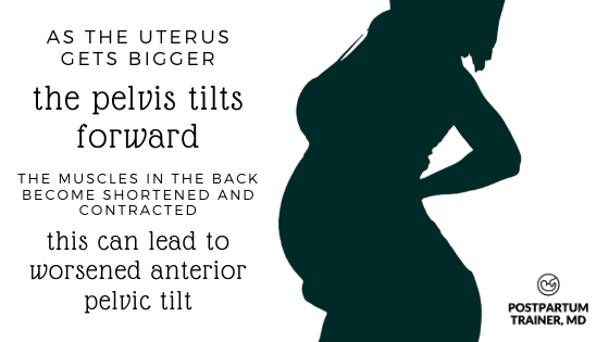 image of pregnant woman holding her back due to anterior pelvic tilt