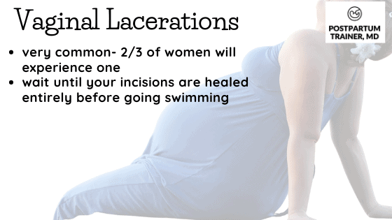 more than 2/3rds of women will experience a vaginal laceration during delivery