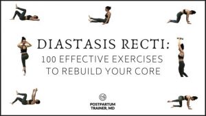 how-to-fix-diastasis-recti