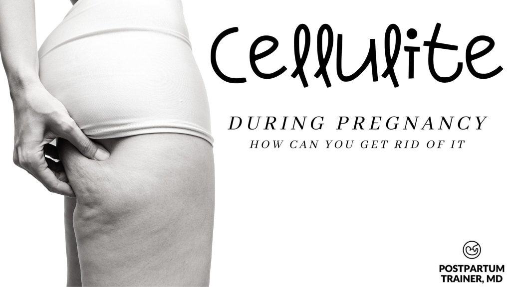 cellulite-in-pregnancy